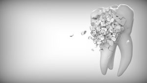 tooth break apart